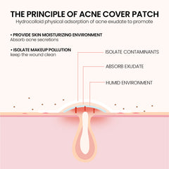 Cute Star Hydrocolloid Acne Pimple Patches